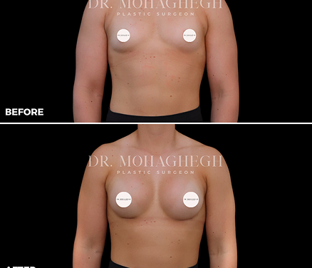 breast-treatment